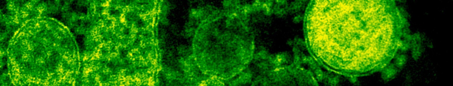 Hepatitis causada por virus es la más común: Zulima Ramos Lugo