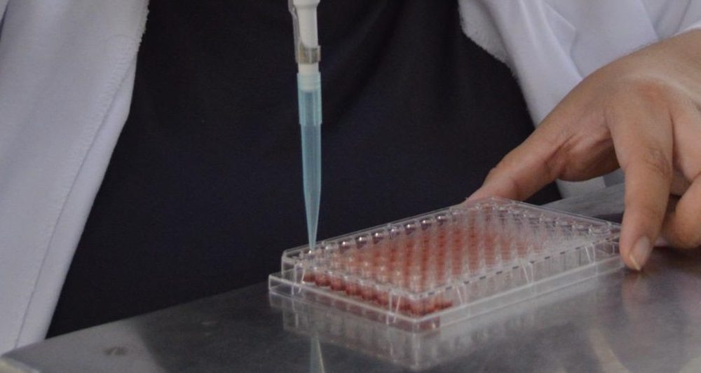 Investigan proteína de garbanzo para tratamiento de hipertensión, en campus Navojoa